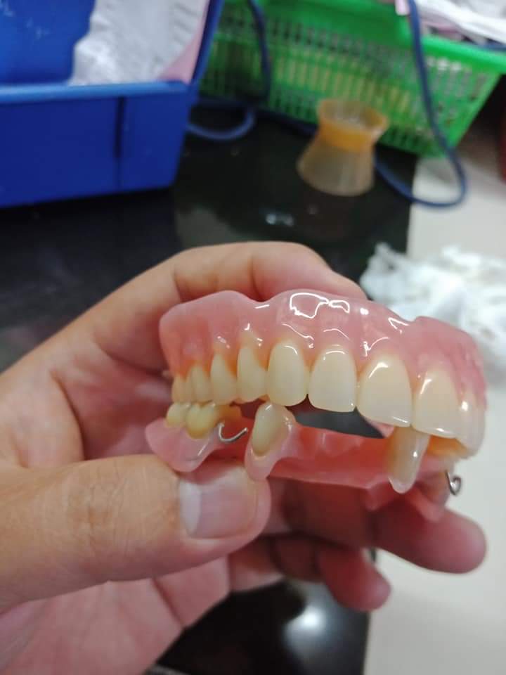 pasang gigi palsu citeureup