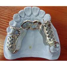 pasang gigi palsu bogor barat